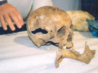 blCzeslaw1